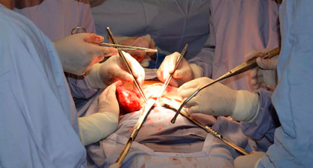  Evaluación pre y post trasplante renal